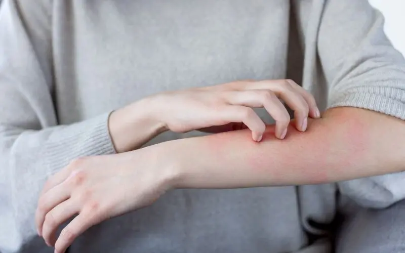 People with allergies should be careful when eating spinach to avoid an unwanted reaction